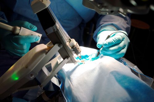 Transplant realizat cu ajutorul robotului chirurgical Poza 29498