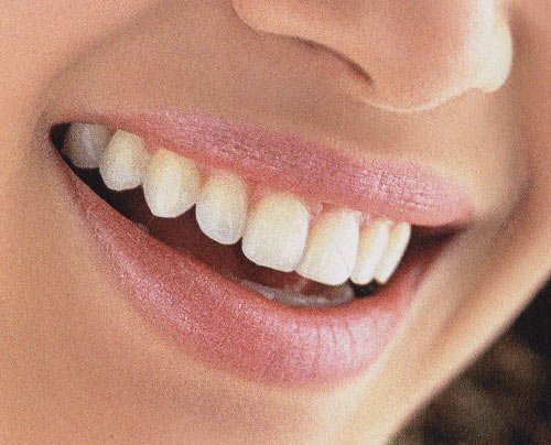 Lipsa sau degradarea dinţilor, cauză a depresiei