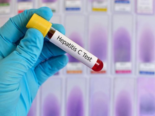 Un singur tratament fără interferon în caz de hepatită