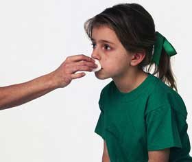 Măsuri de urgenţă şi remedii în cazul sângerărilor nazale 95496