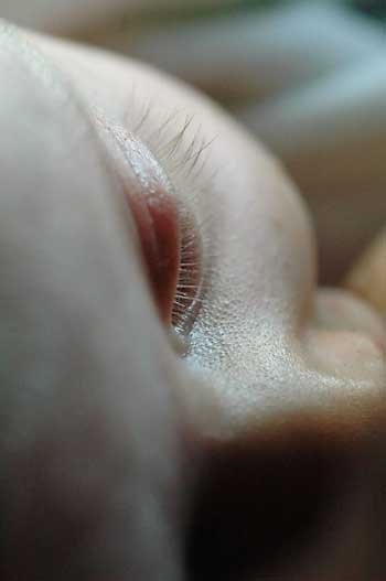 Cum recunoaştem diverse afecţiuni ale ochilor la nou-născut 97352