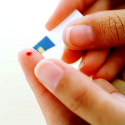 Despre recoltarea probelor biologice 98466