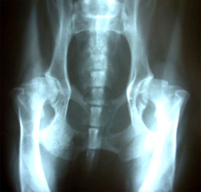 Despre terapia reumatismului 100987