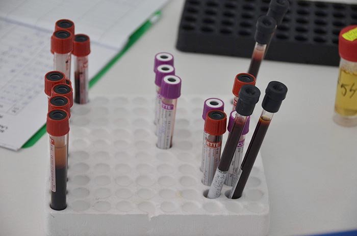 Depresia ar putea fi depistată doar printr-un test de sânge 105982