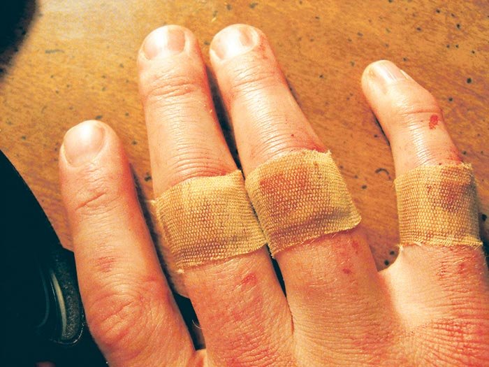 S-a inventat bandajul inteligent 106422