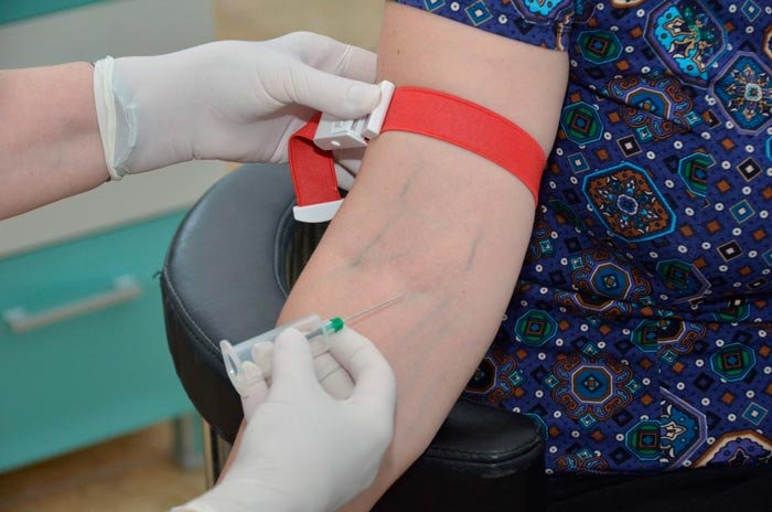 Teste gratuite pentru depsitarea hepatitei de tip B 108361