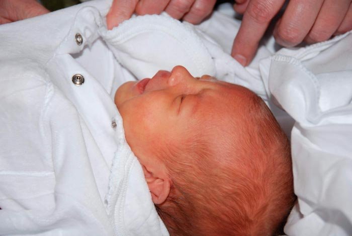 De ce apare şi cum se manifestă eczema sugarului 108564