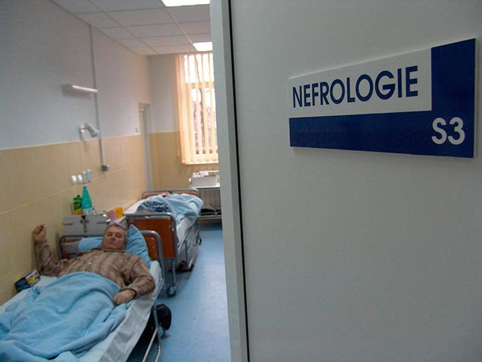 Posibile complicaţii în litiaza renală 109697