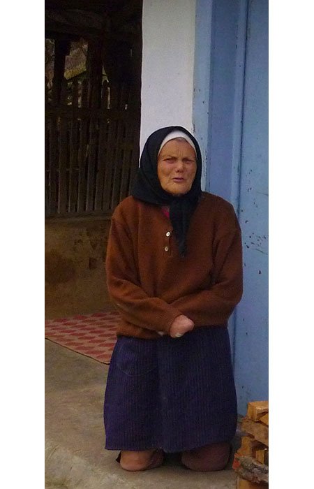 Chipuri ale răbdării desfigurate de boală 91509