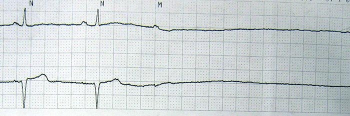 Inimă şi cord 91597