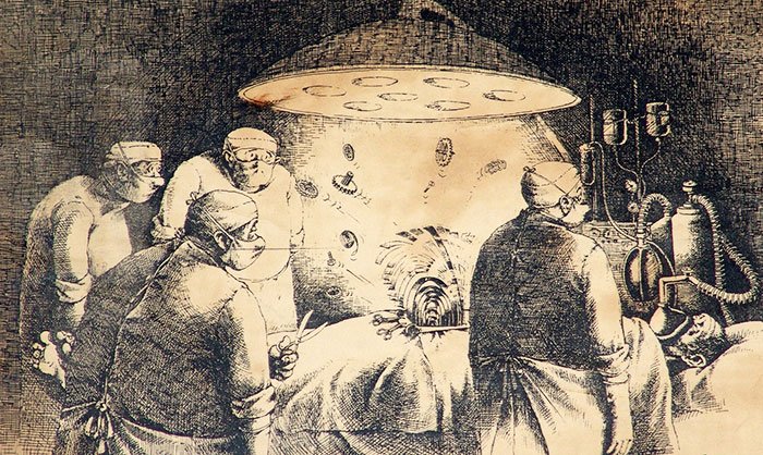 Din avatarurile chirurgiei 91769