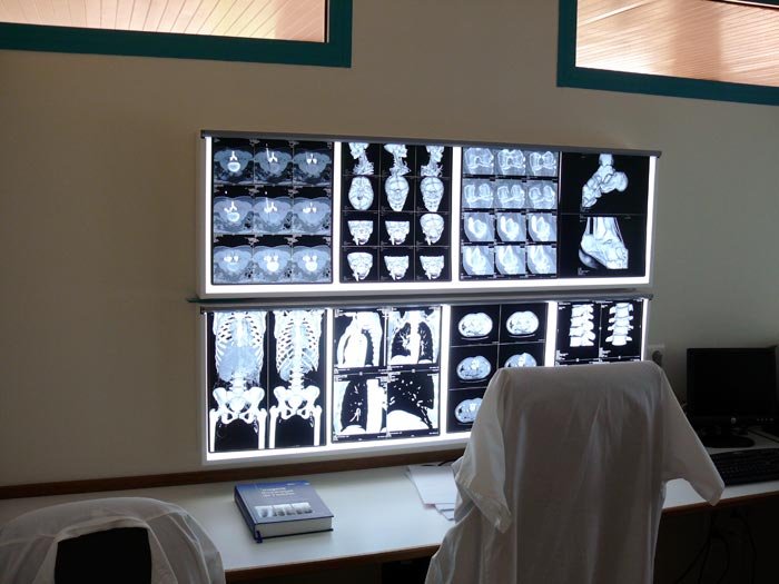 Coplată pentru consultaţii şi spitalizare 90250