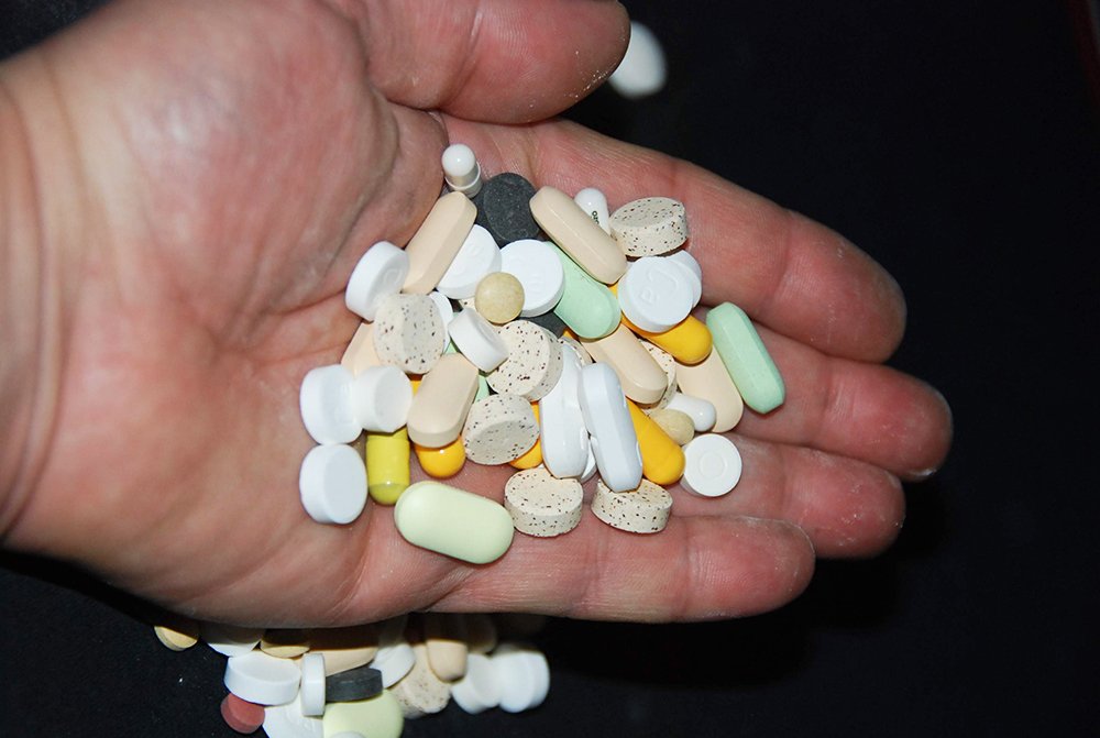 O nevralgie rebelă 89168