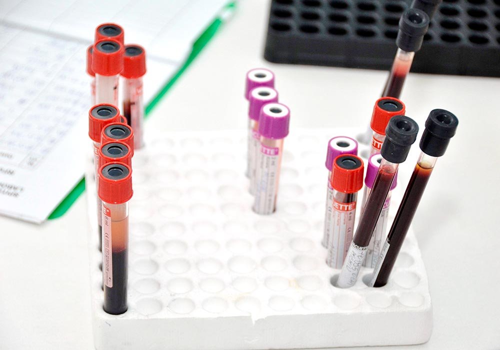 Incidenţă alarmantă a cancerului de col 79424