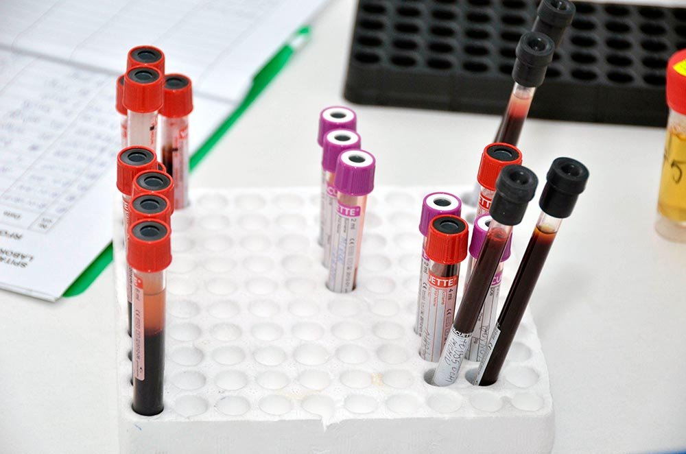 Teste Babeş-Papanicolau gratuite în 9 centre medicale 78513