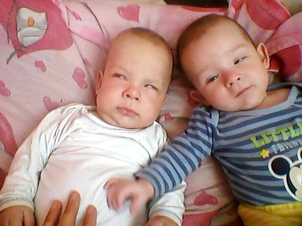 Doi gemeni au nevoie de ajutor pentru a vedea 75491