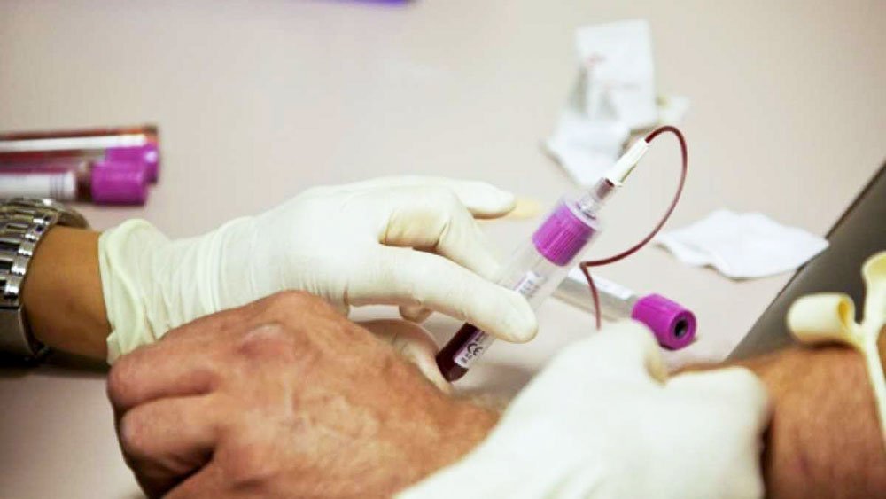 Terapii noi pentru hepatita C 72905