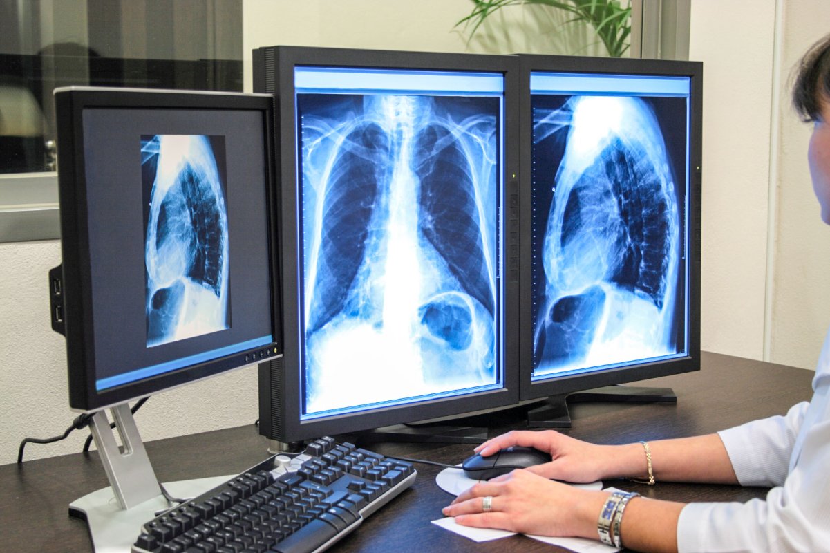 Screeningul și diagnosticul precoce pot salva vieți 27041