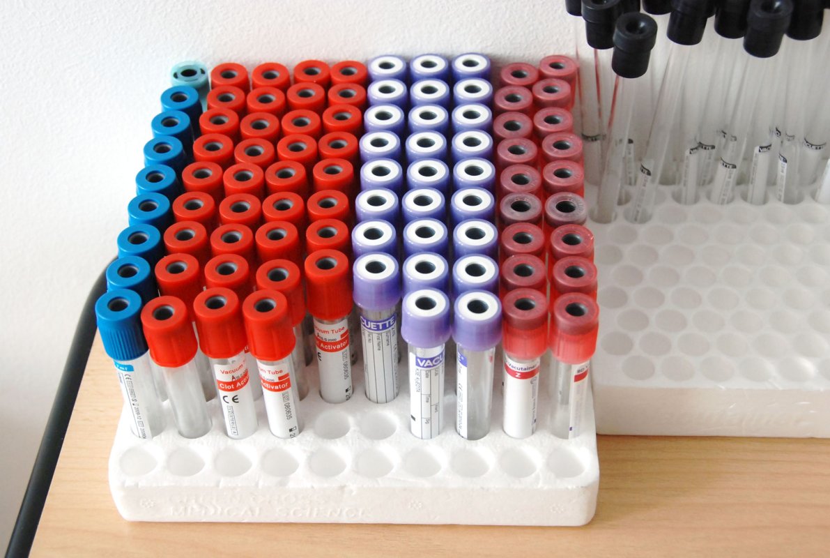 România cere ajutor pentru a ieşi din criza imunoglobulinei 22473