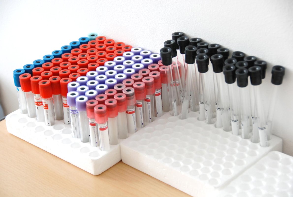 Pacienții cu hemofilie au acces dificil la tratament 7641