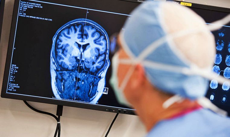 Operații pentru reducerea crizelor la epileptici 140068