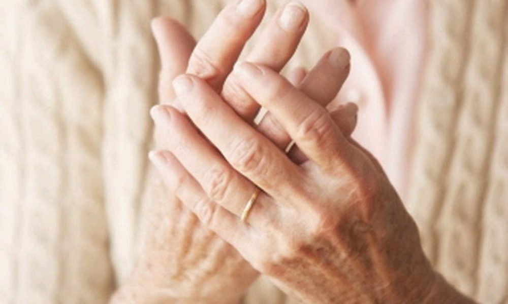 Peste 10.000 de români afectați de reumatisme inflamatorii 140468