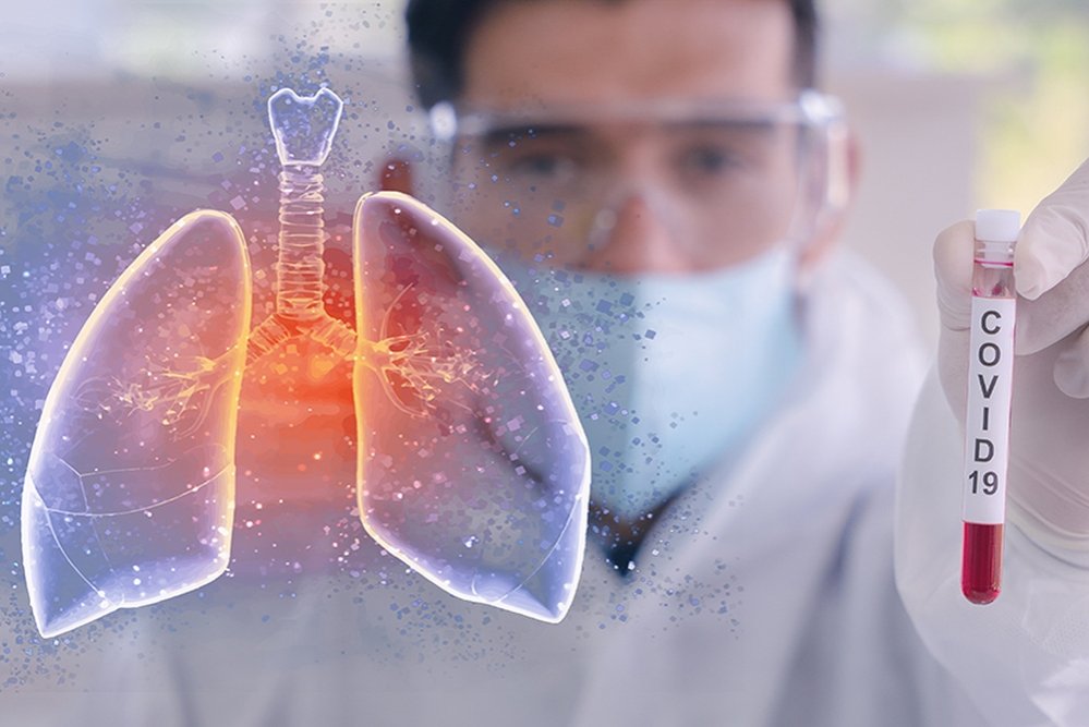 Șase grupe de simptome ale infecției cu noul coronavirus  149368