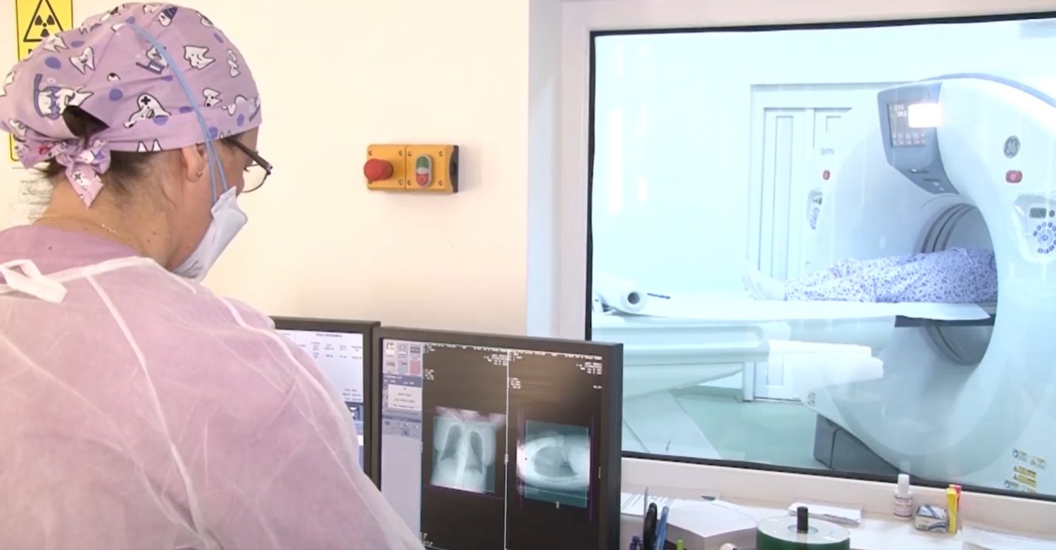 Soft pentru evaluarea nodulilor pulmonari 153981