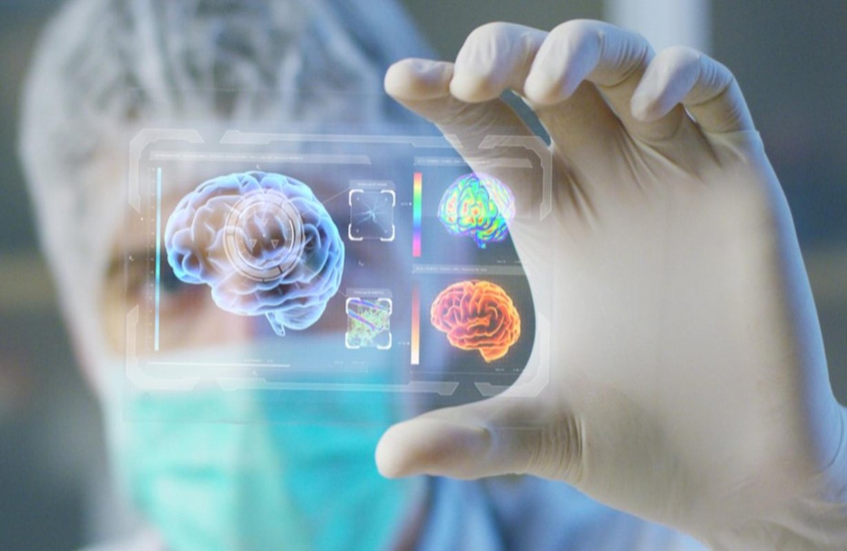 Microflora intestinală și boala Alzheimer 157806