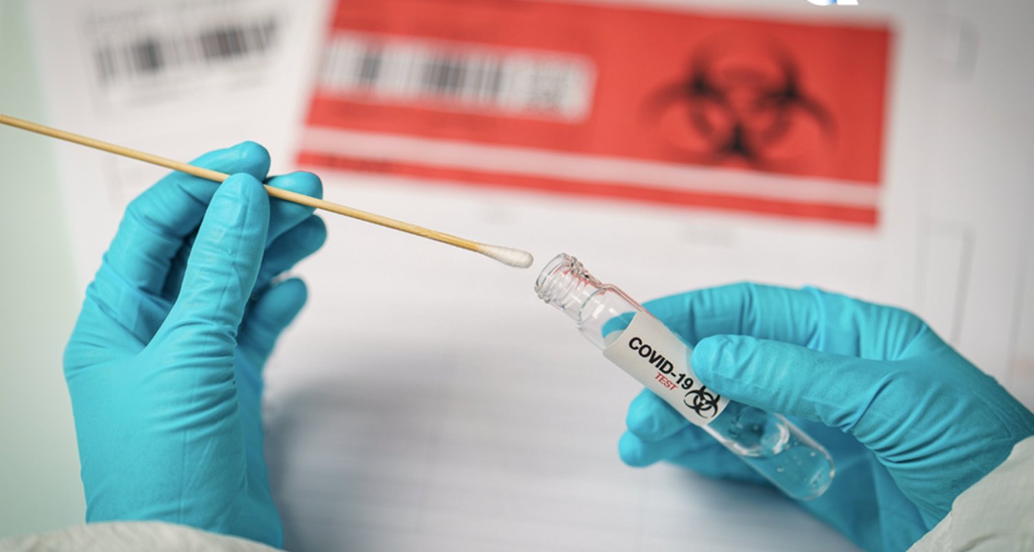 Pandemia  de COVID-19,  un an de la primele cazuri 160135