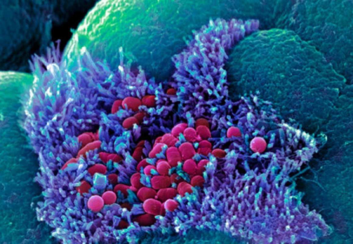 Zeci de mii de tipuri de virusuri  din intestin, necunoscute până acum 165200