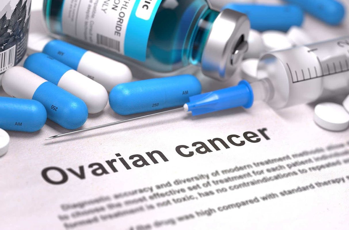 Cancerul ovarian, vindecabil în stadii incipiente 171598