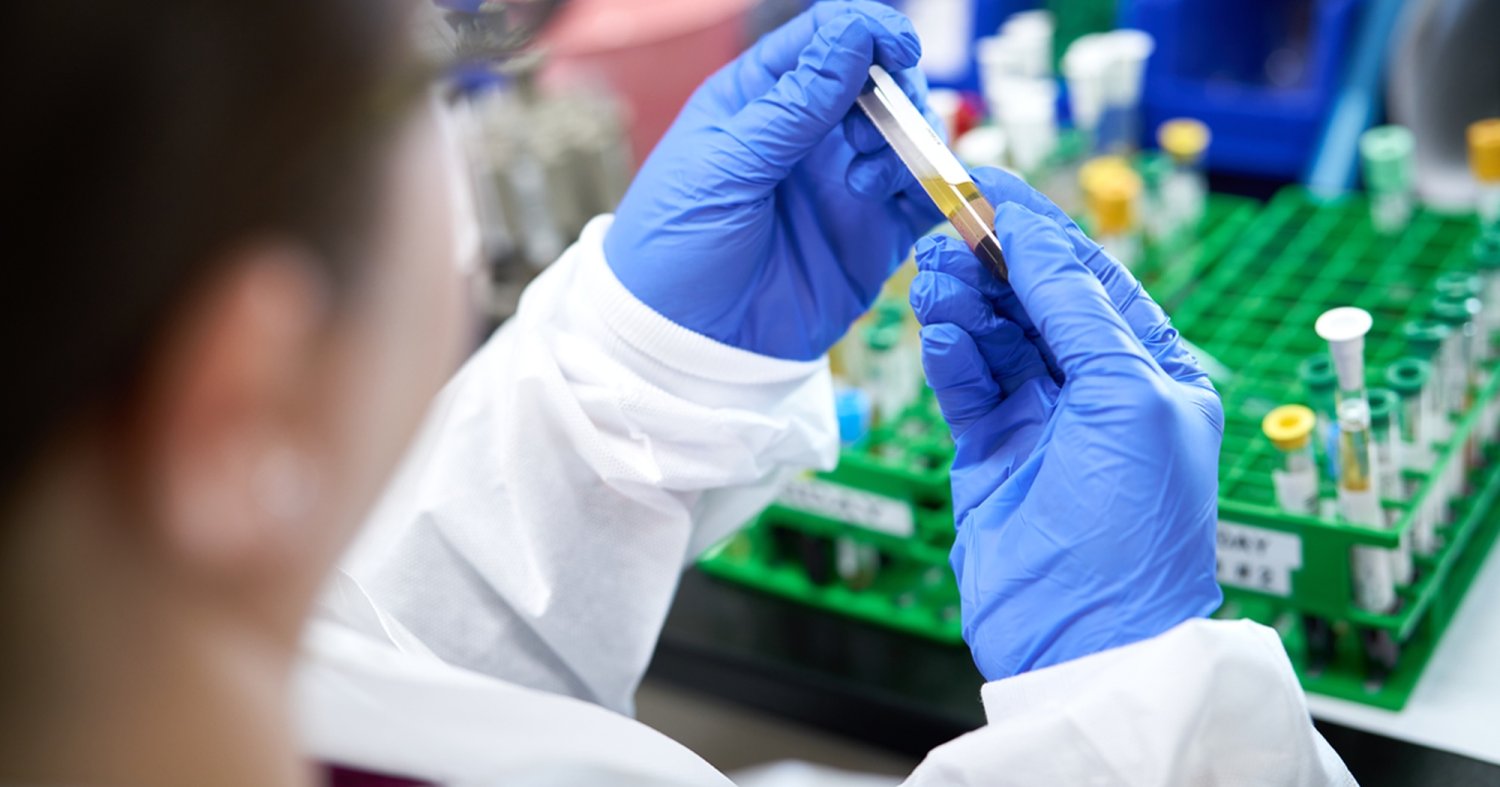 Terapii inovatoare în cancerele hematologice 181306