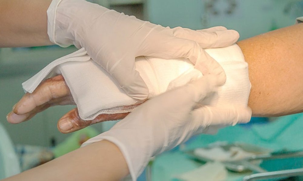 Facilități noi pentru pacienții cu arsuri 182646