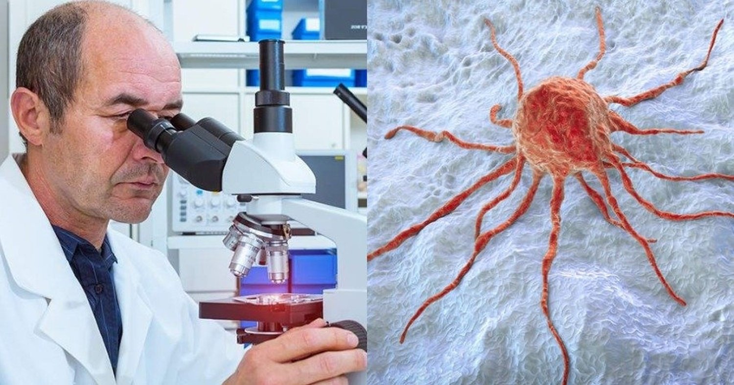 Test inovativ de depistare a cancerului 184493