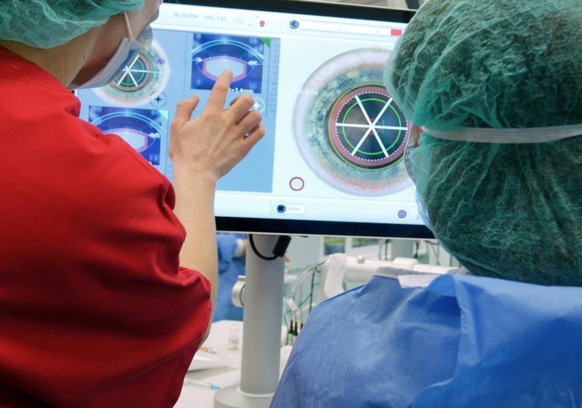 Operația de cataractă, beneficii nebănuite  195981