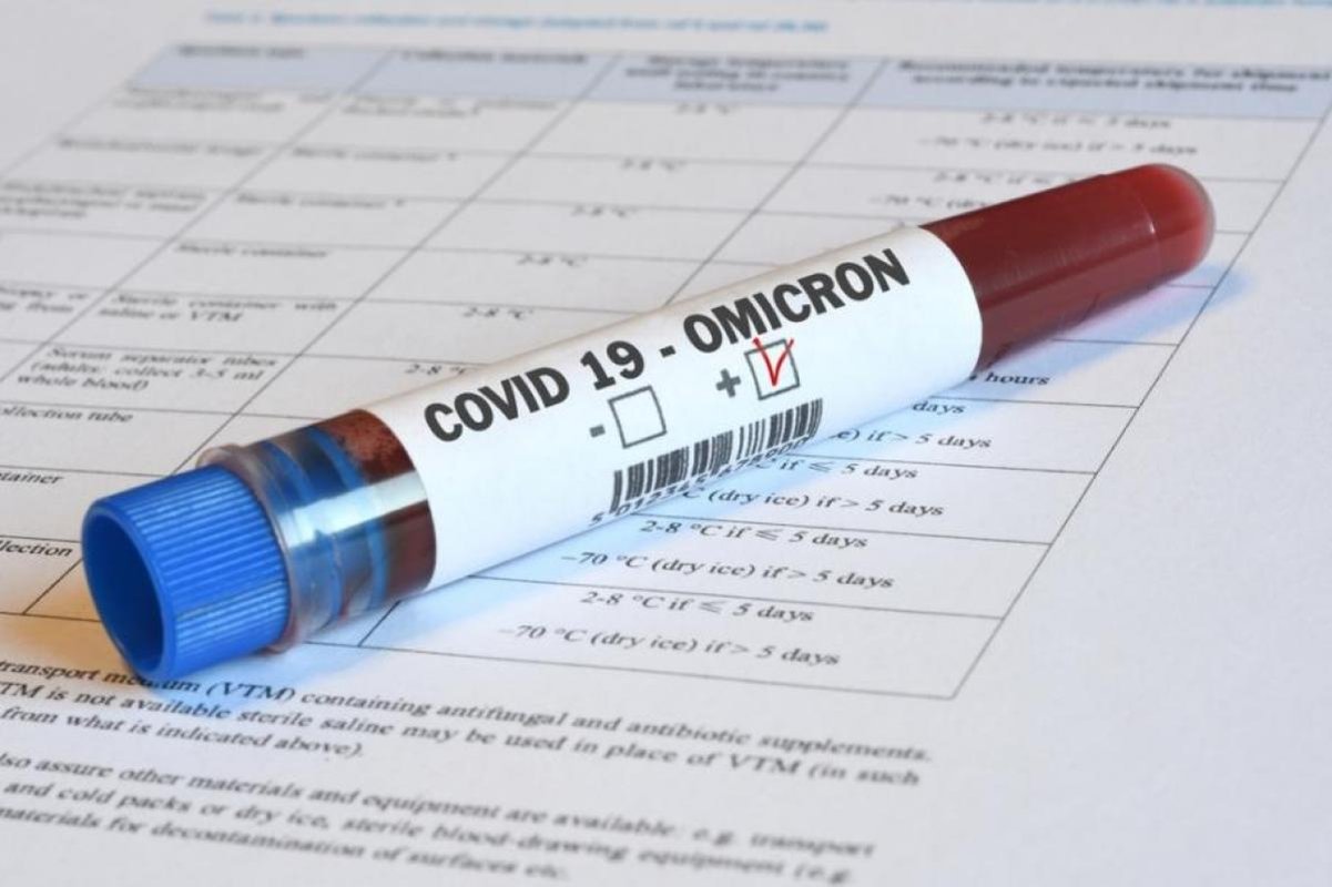 Omicron, dominant în marile oraşe 201429