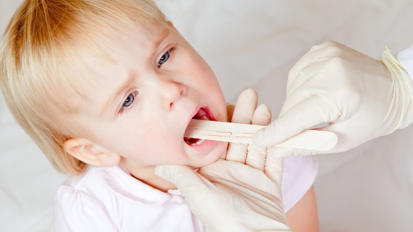 Antibioticele, interzise în tratarea herpanginei 217647