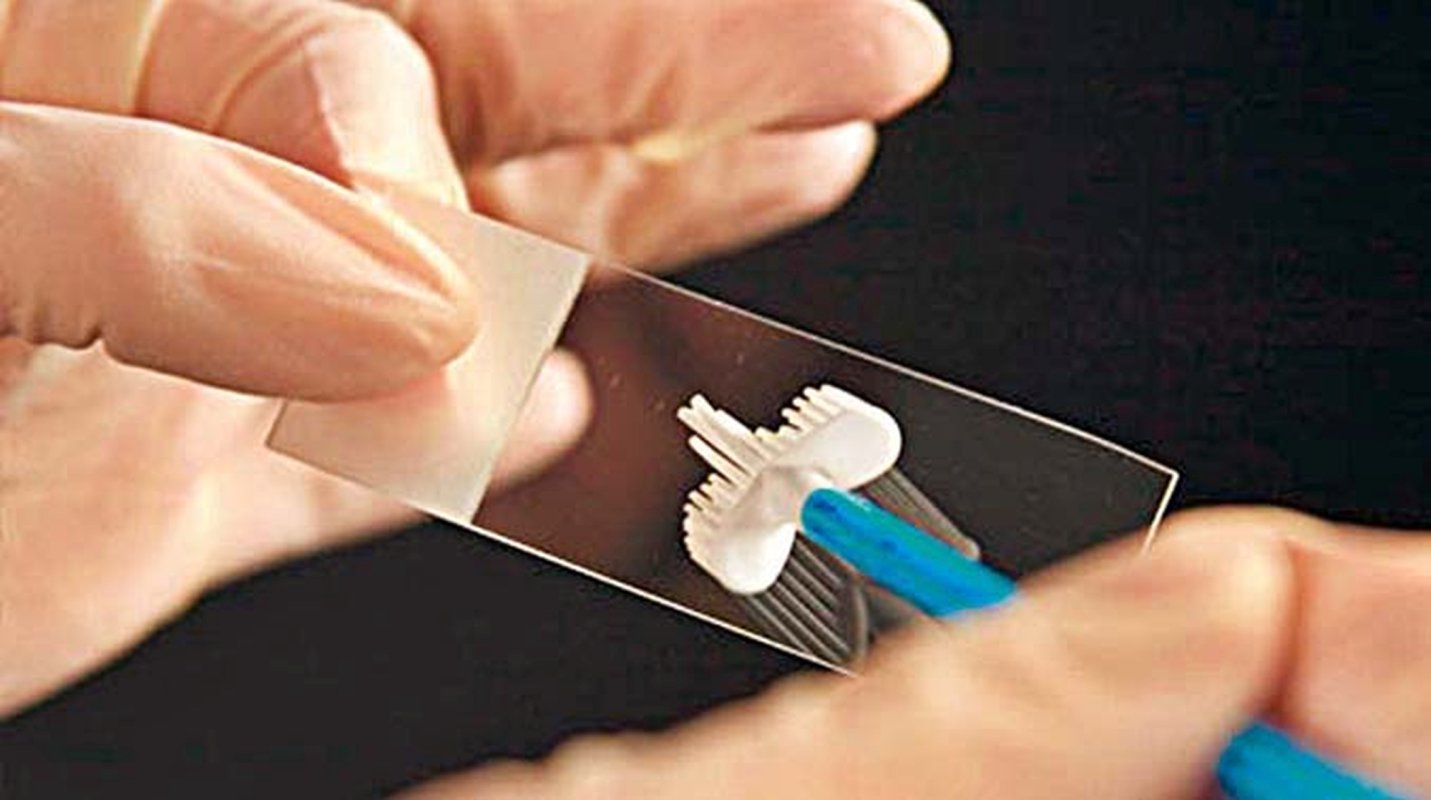 Testări gratuite pentru cancerul uterin 217649