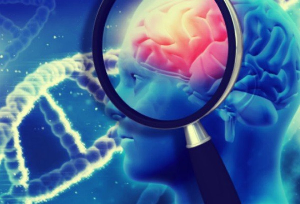 Posibil caz de Alzheimer la un tânăr 244235