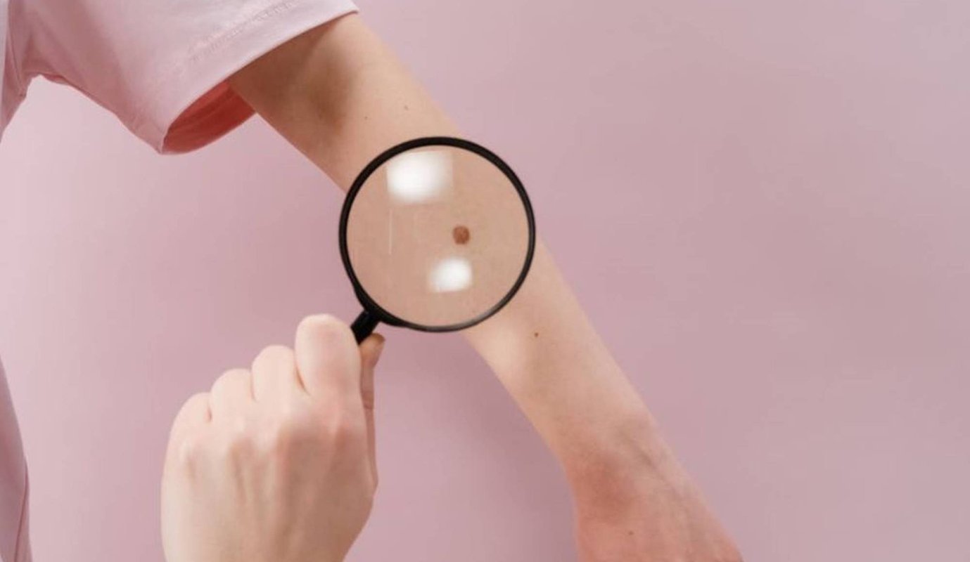 Riscurile arsurilor solare din copilărie 254476