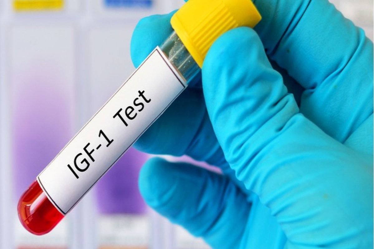 Acromegalia, boală cu evoluție dificil de sesizat 276196