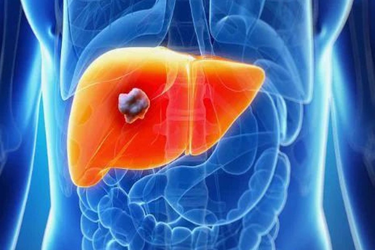 Organe care îmbătrânesc mai repede 280669