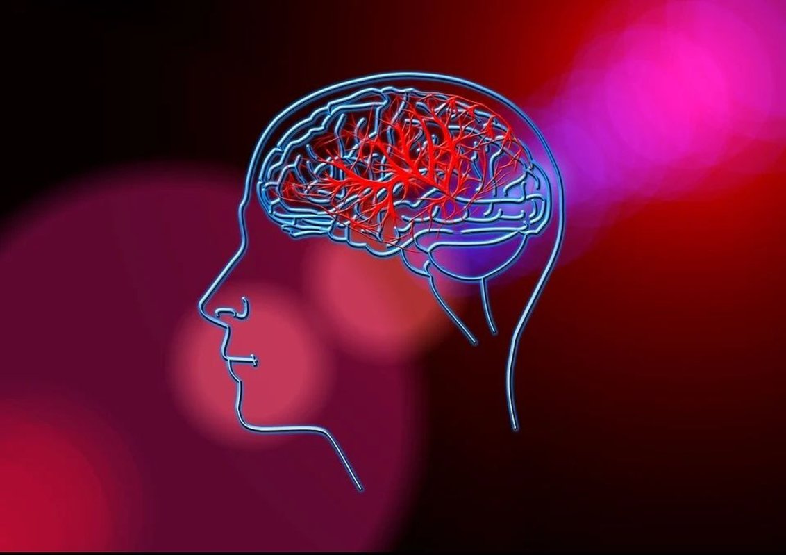 AVC, posibil și la copii 289298