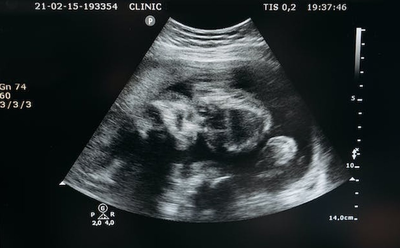 „Viaţa e un dar de la Creator” 290064