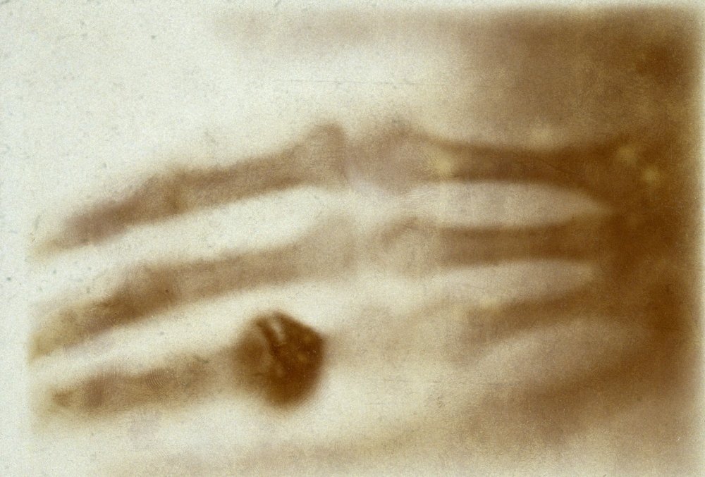 Noi documente incluse în Registrul „Memoria Lumii” 329726