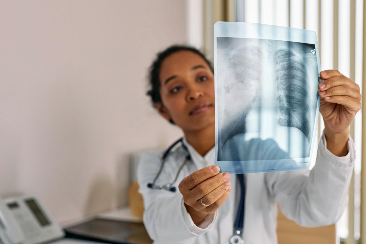 Hipertensiunea pulmonară, o urgență medicală 358769