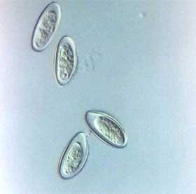 Cum se produce contaminarea cu paraziţi intestinali Poza 94761