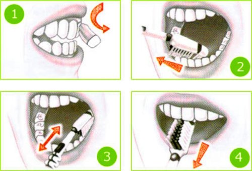 Cum se realizează corect periajul dentar