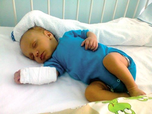 Un bebeluş are nevoie de transplant de ficat Poza 85406